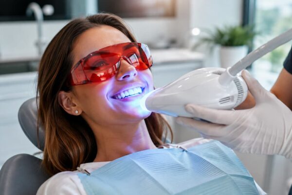 Zâmbet alb înainte de un eveniment important: ce trebuie să știi despre albirea dentară